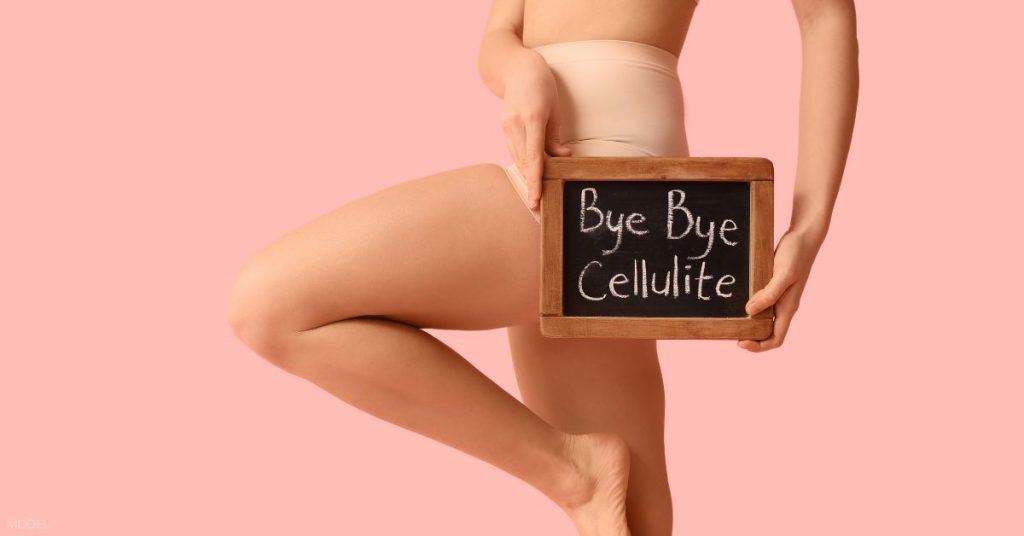 A woman in workout clothes holding a sign that reads: "Bye Bye Cellulite". (MODEL)